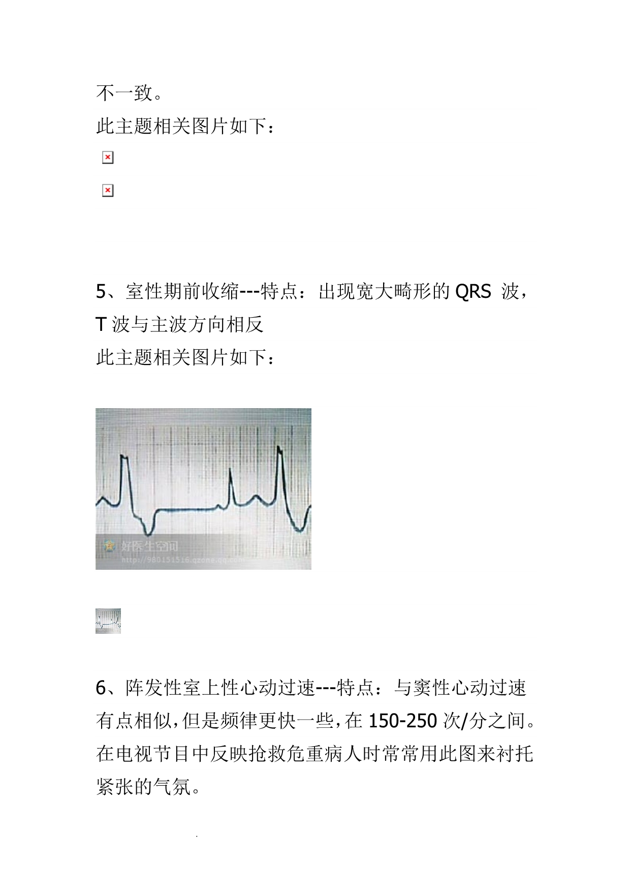 （推荐）心电图的记忆方法_第5页