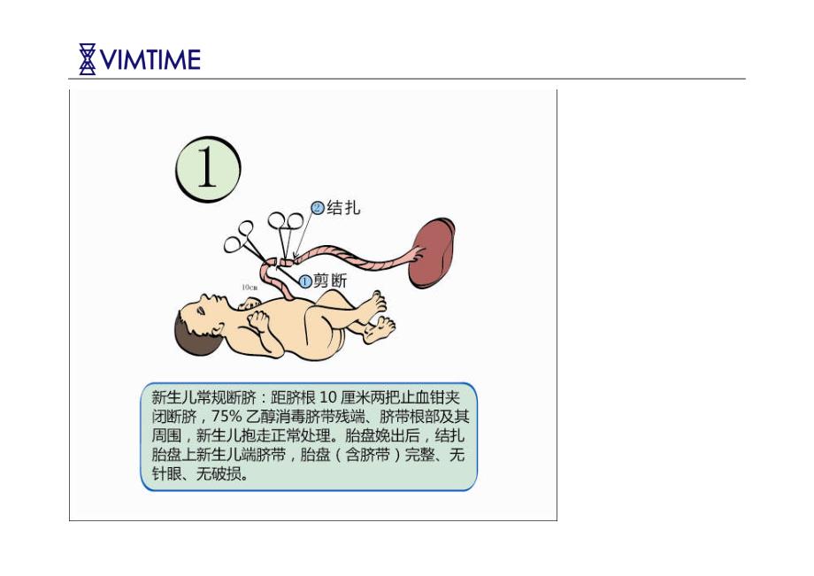 脐带胎盘干细胞采集流程.doc_第4页