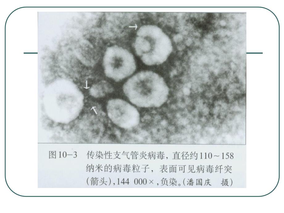 病原体鸡传染性支气管炎病毒.ppt_第4页