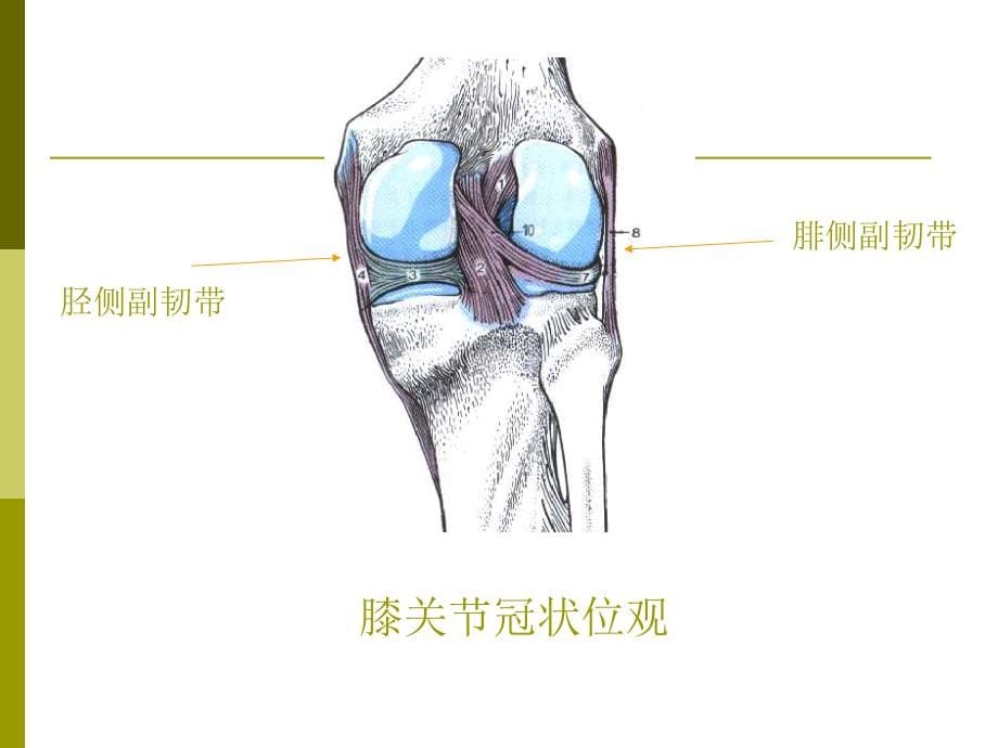 膝关节常见疾病MR诊断.ppt_第5页