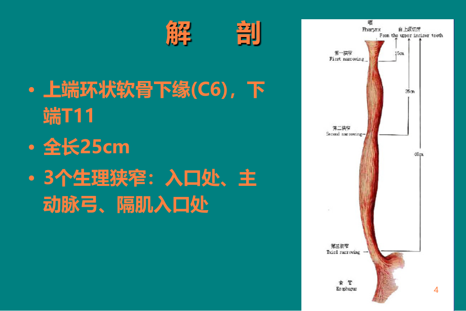 食管癌放疗讲座PPT课件_第4页