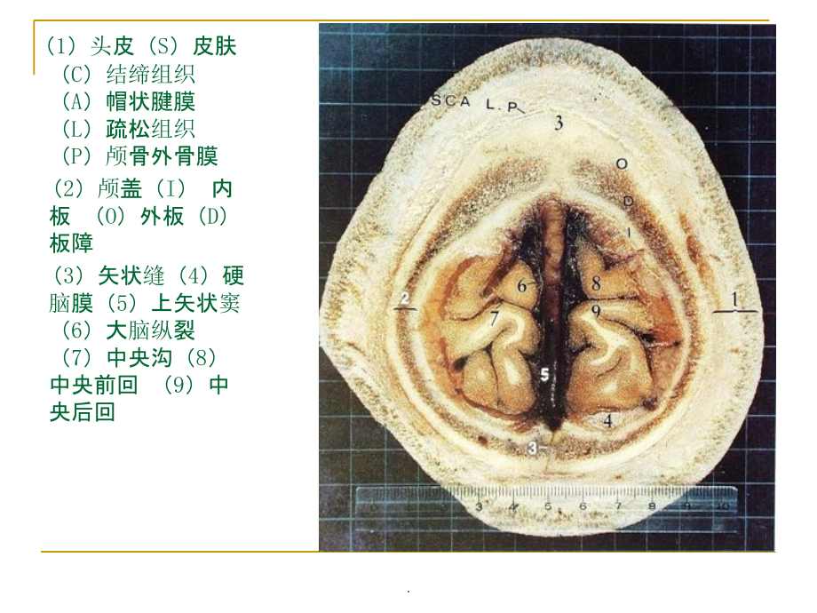 人体断层解剖图谱(大脑)PPT课件_第3页