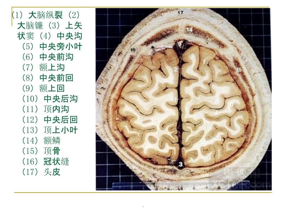 人体断层解剖图谱(大脑)PPT课件_第5页