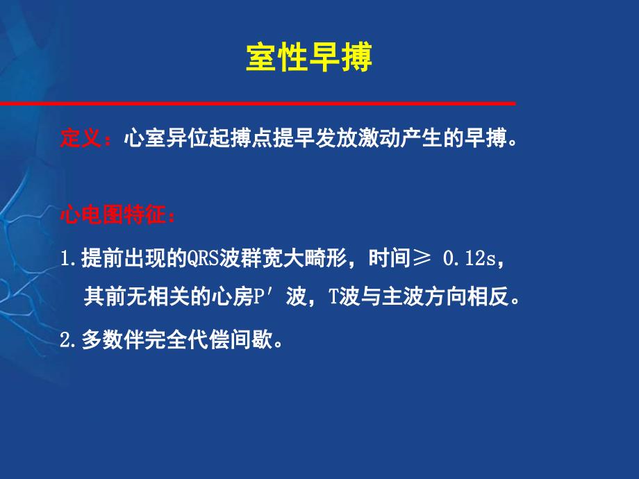 室性早搏的定位诊断与鉴别.ppt_第2页