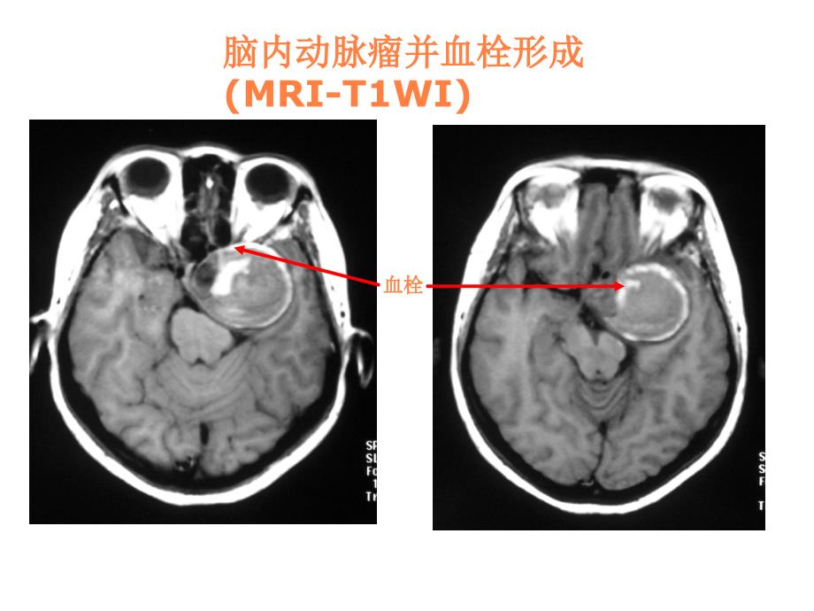 湘雅颅脑应用解剖PPT课件_第3页