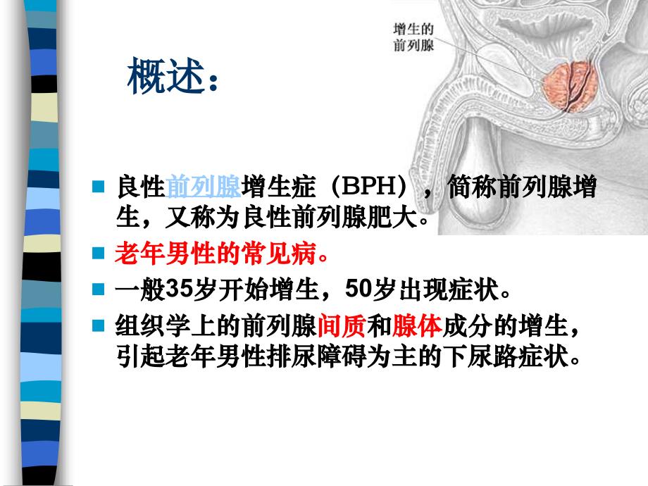 前列腺增生的基础知识.ppt_第2页