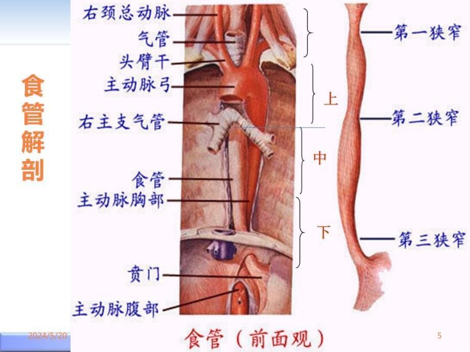 学习课件第十二章第四节食管癌病人的护理ppt课件_第5页