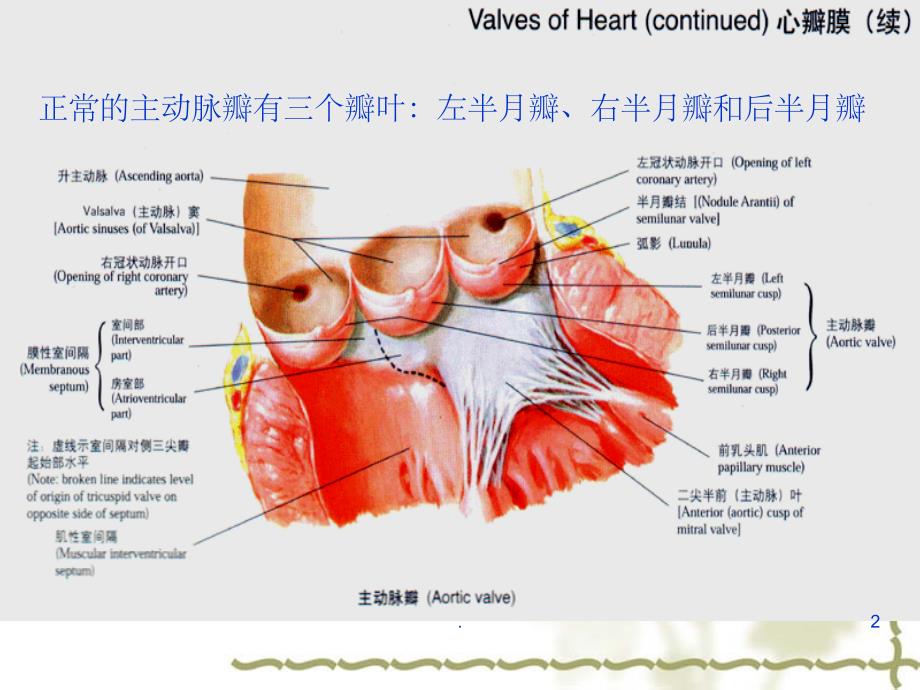 主动脉瓣置换术后的护理PPT课件_第2页