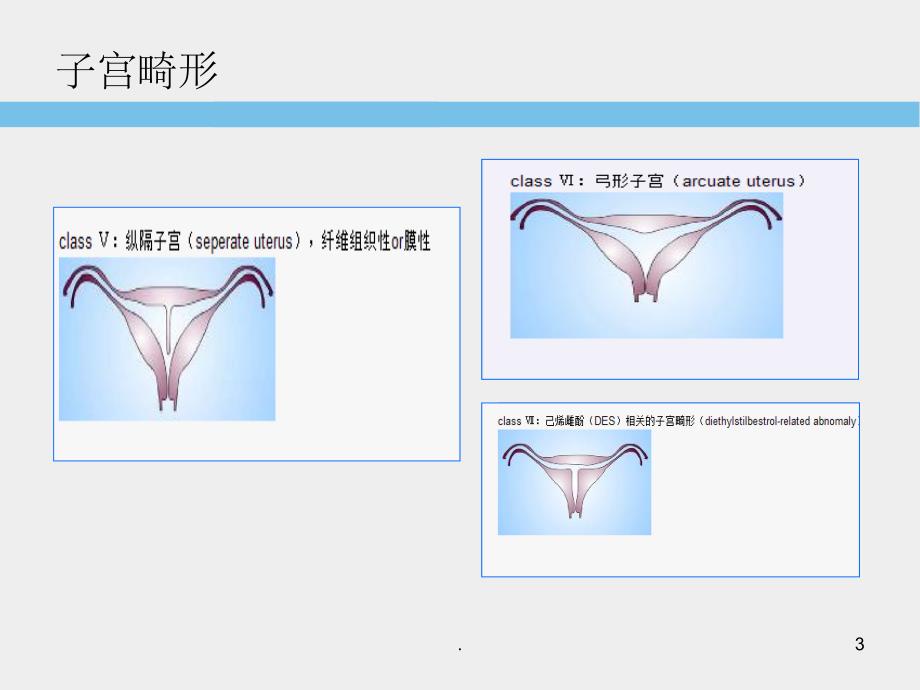 子宫畸形超声诊断标准及思路PPT课件_第3页