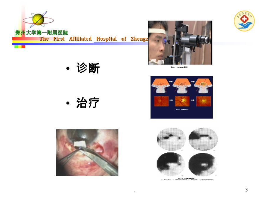 青光眼的药物治疗70372PPT课件_第3页