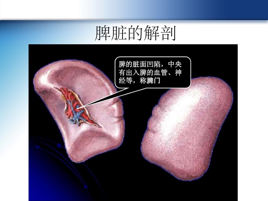 脾破裂的超声诊断PPT课件_第2页