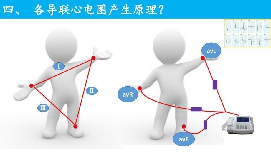 正常心电图解读（2020年整理）.ppt_第5页