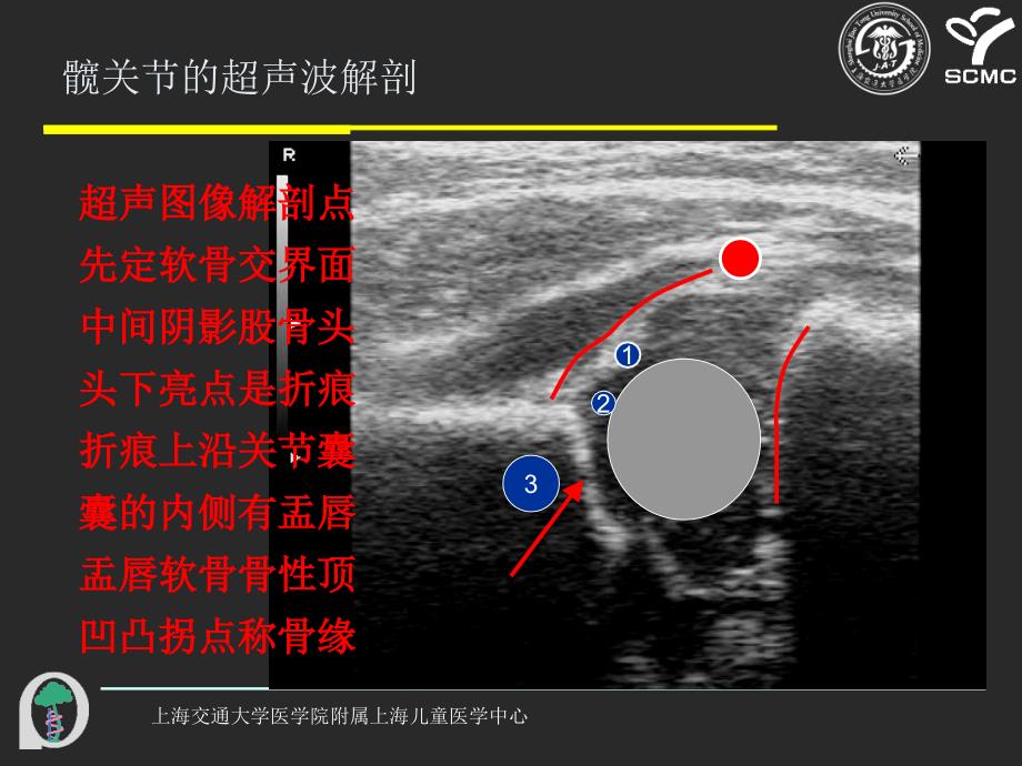 髋关节超声波检查的操作教学提纲_第2页