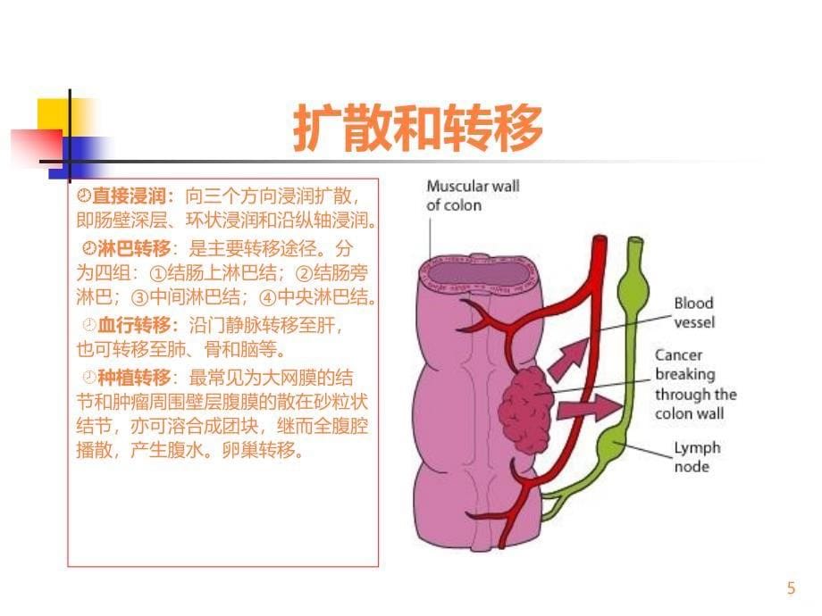 结肠癌根治术ppt课件_第5页