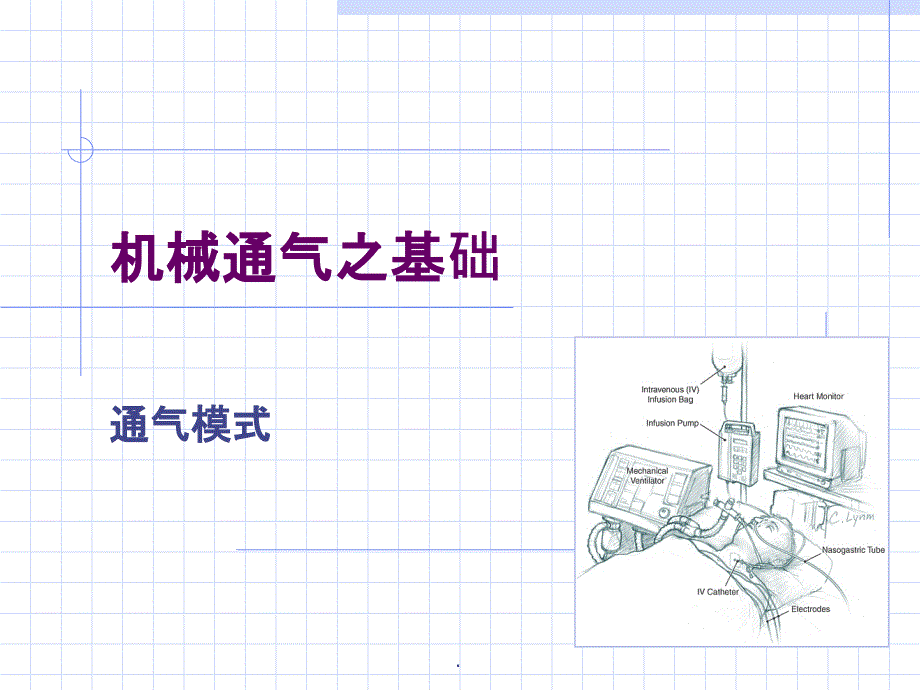 呼吸机模式03877ppt课件_第1页