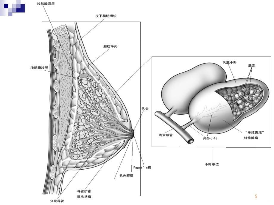 乳房疾病武正炎ppt课件_第5页