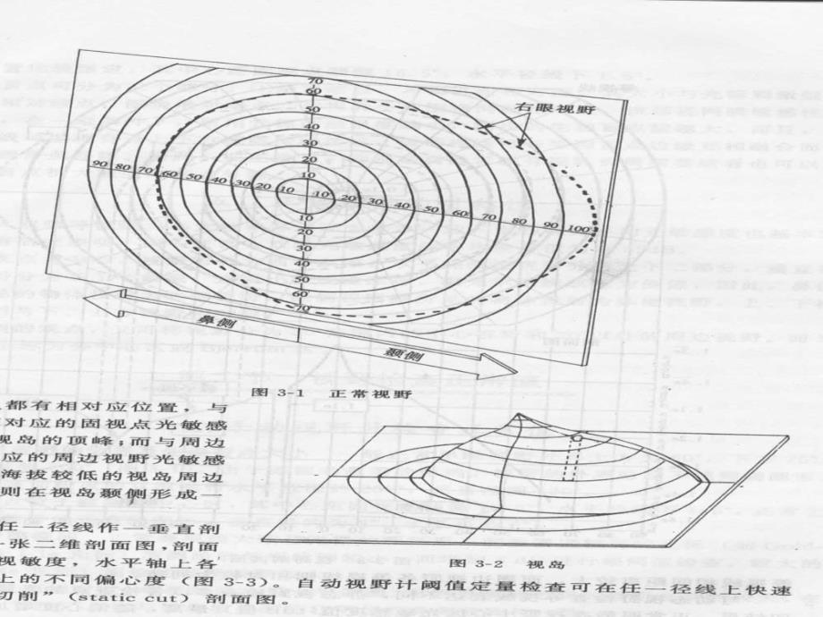 视野学 眼科临床视野检测ppt课件_第4页