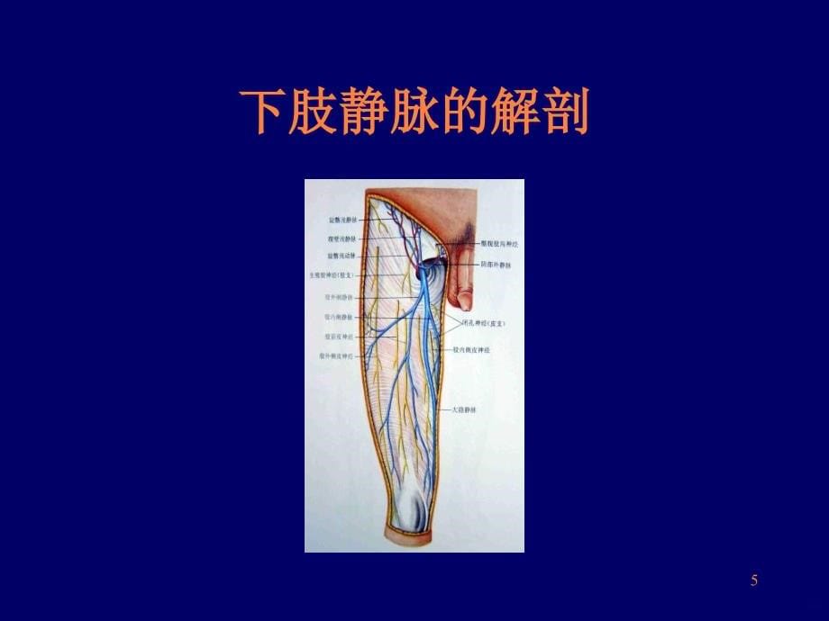 肢静脉血栓ppt课件_第5页