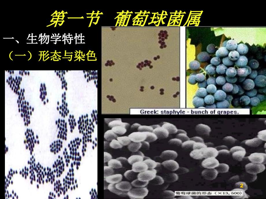 医疗球菌葡链ppt课件_第2页