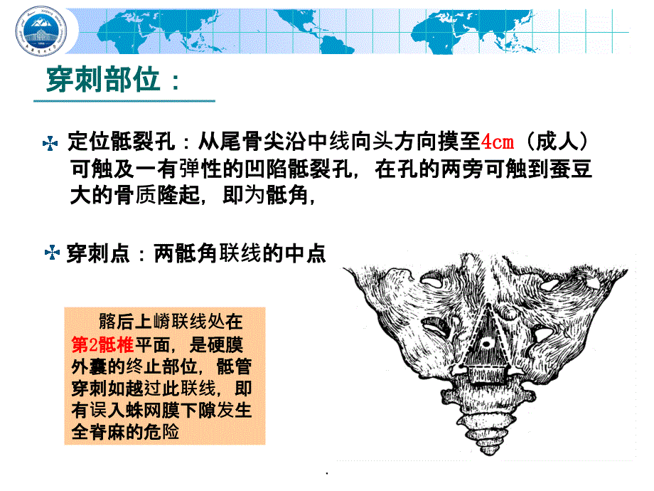 骶管麻醉1ppt课件_第4页