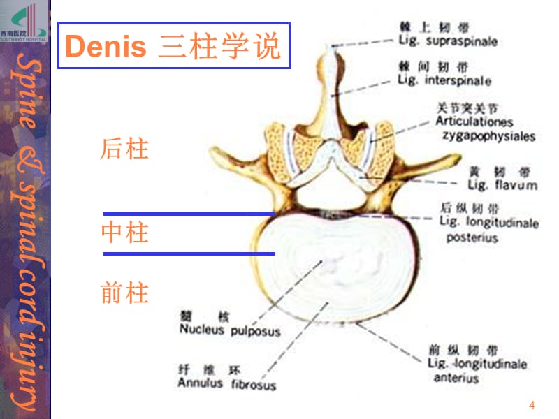 本科6版脊柱和脊髓损伤ppt课件_第4页