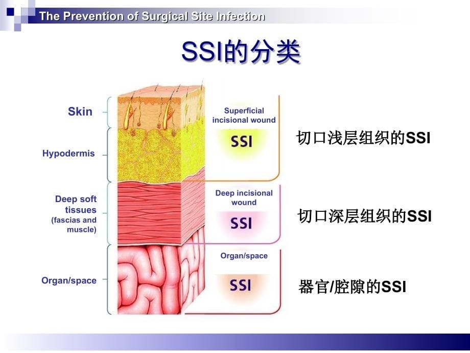 手术部位感染预防与控制新学习资料_第5页