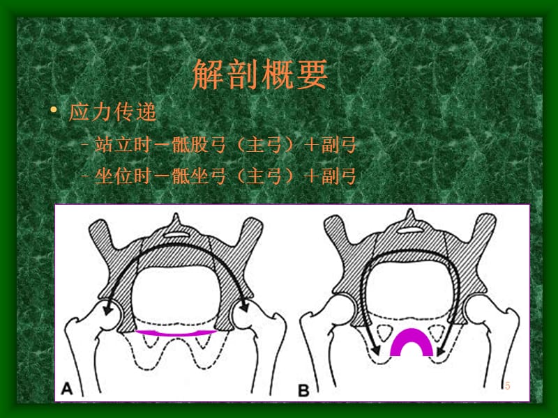 骨盆骨折六院ppt课件_第5页