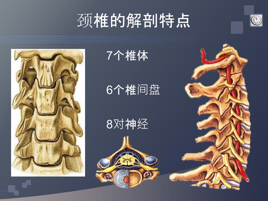 颈椎病的CT诊断ppt课件_第3页