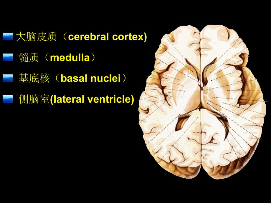 临床医学讲解习题考题端脑_黄颖(改)_2006.9.10_第3页