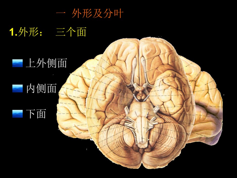 临床医学讲解习题考题端脑_黄颖(改)_2006.9.10_第4页