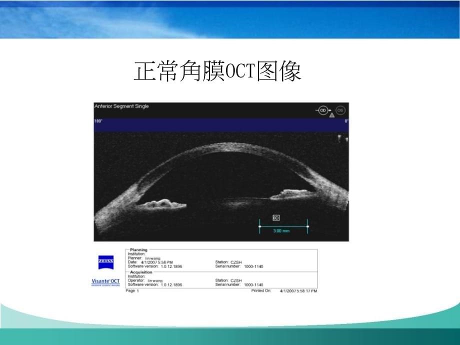 临床医学讲解习题考题2015.3.5 Cornea Disease_第5页