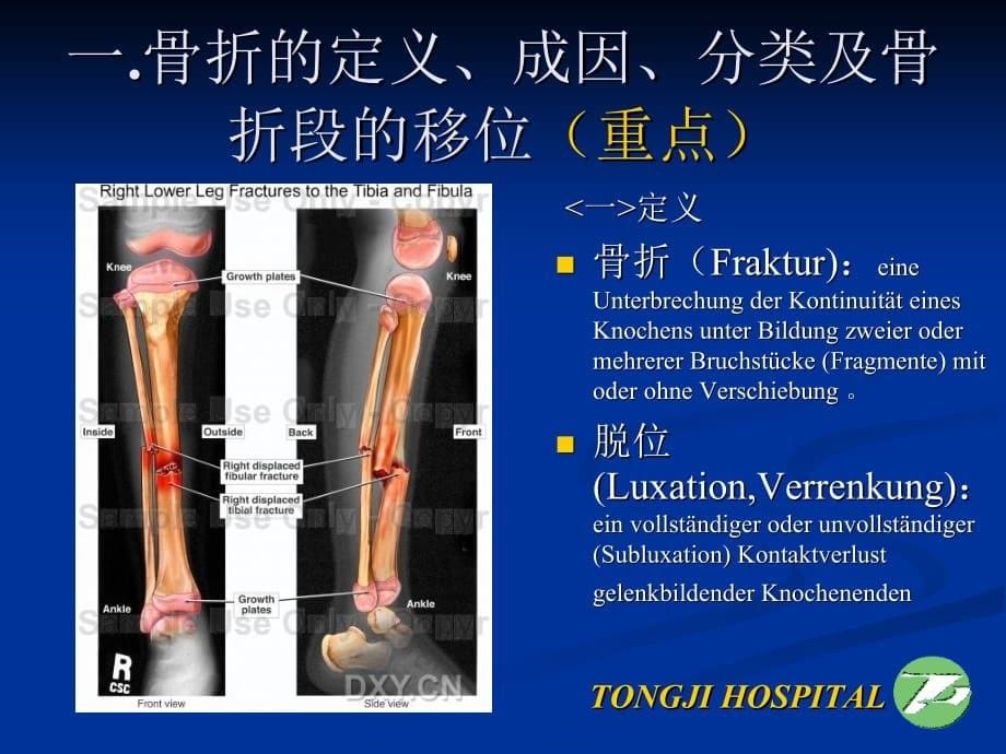 临床医学讲解习题考题骨折概论（SK-14）_第5页