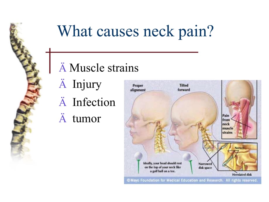 临床医学讲解习题考题neck pain_第4页