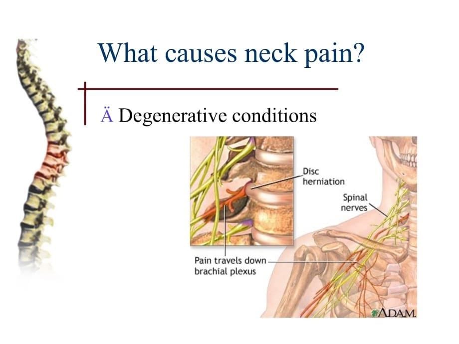 临床医学讲解习题考题neck pain_第5页