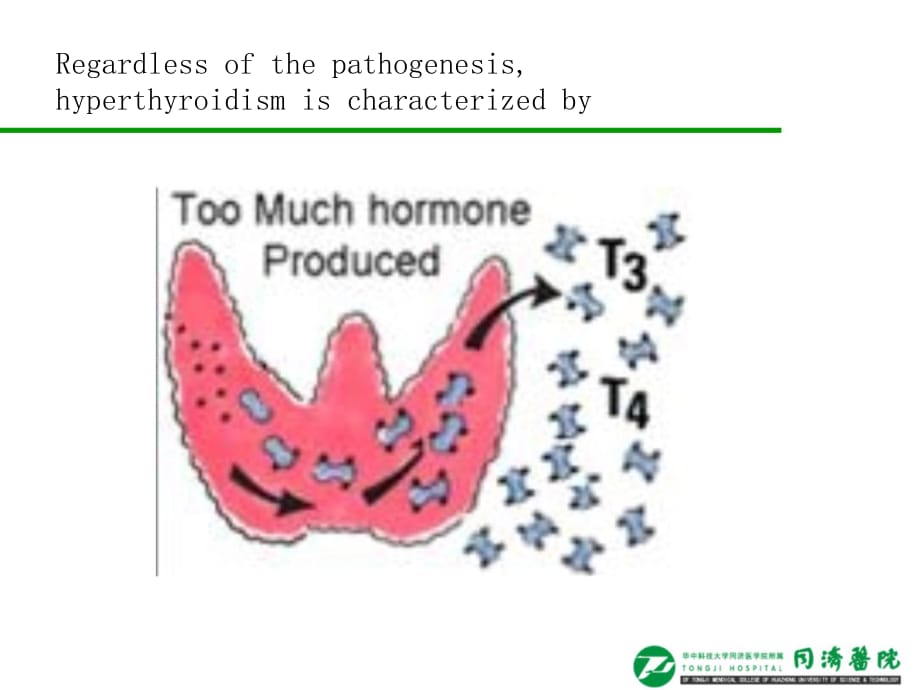 临床医学讲解习题考题Hyperthyroidism yuan 2013_第3页