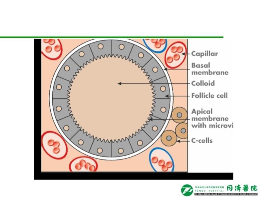 临床医学讲解习题考题Hyperthyroidism yuan 2013_第5页