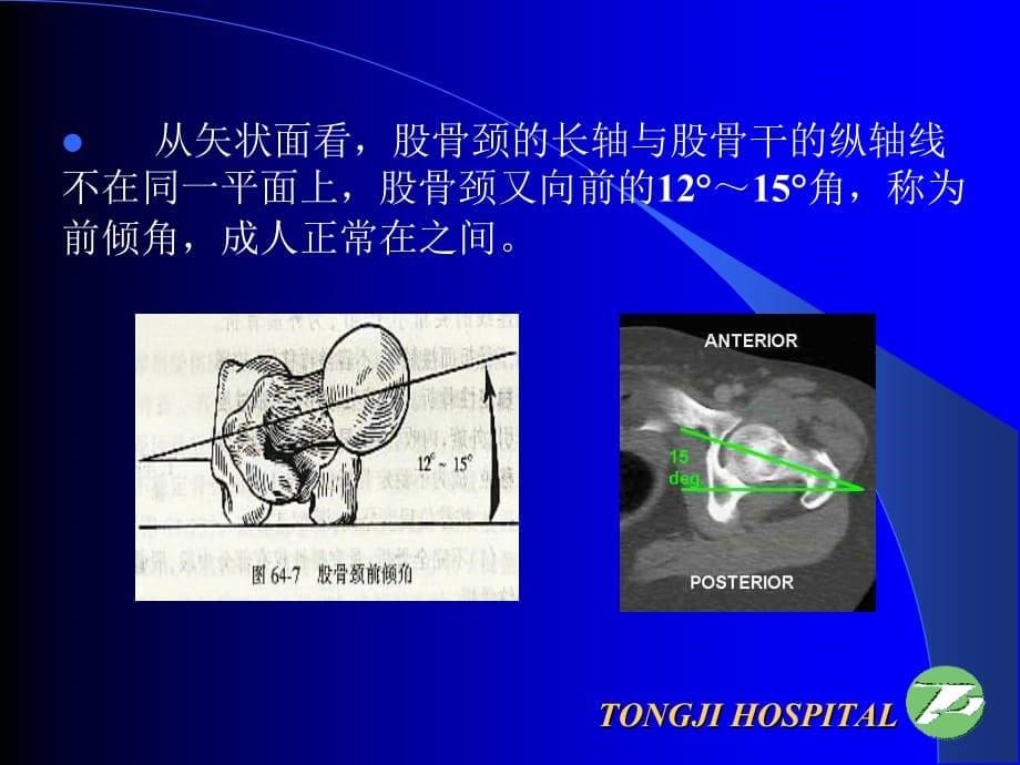 临床医学讲解习题考题下肢骨折、关节损伤_第5页