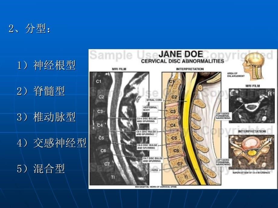 临床医学讲解习题考题颈肩腰腿痛的康复_第5页