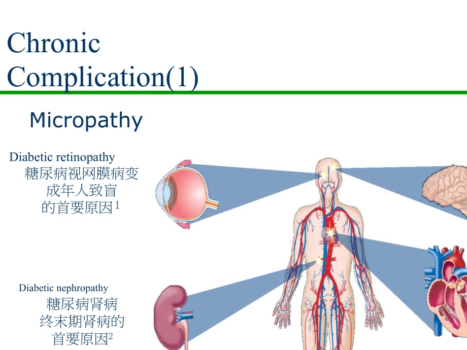 临床医学讲解习题考题2013－DM lecture-1_第4页