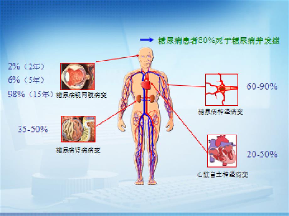 浅谈对糖尿病周围神经病变修改版ppt课件_第4页