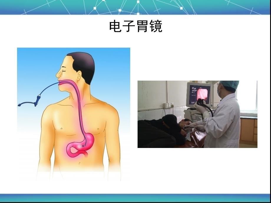 消化内镜操作、诊断及治疗教学提纲_第5页