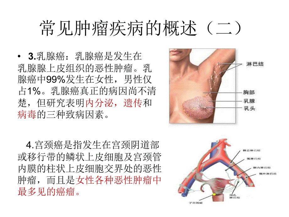 肿瘤常见疾病的护理ppt课件_第4页