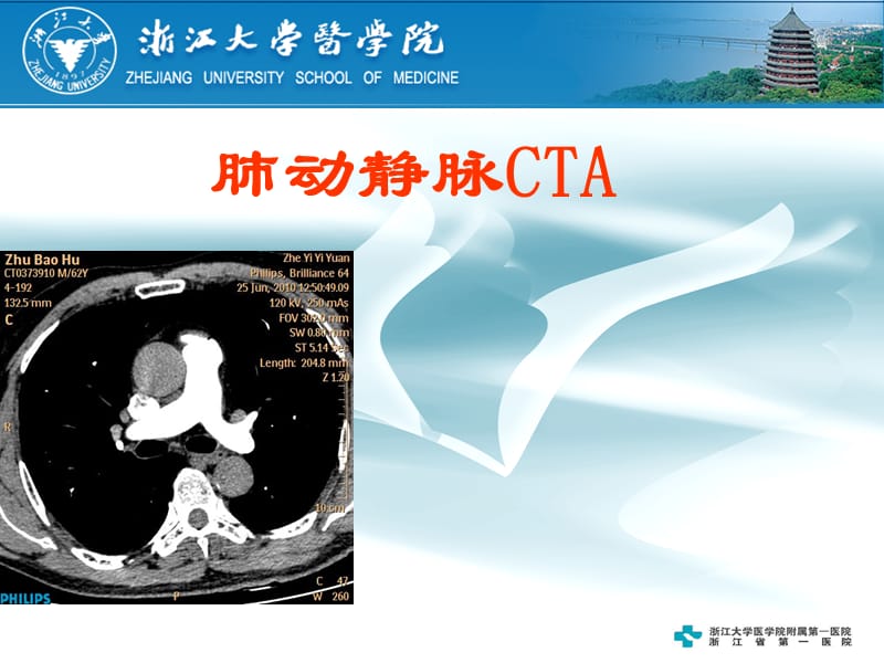 《肺动静脉cta》-精选课件（公开PPT）_第1页