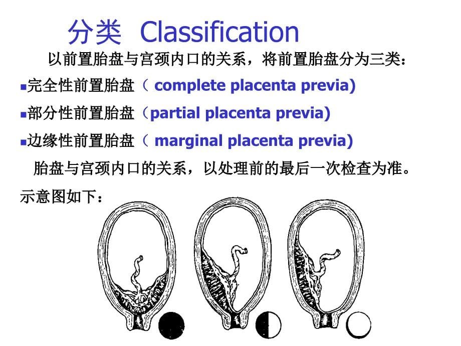 《妇产科护理学》-精选课件（公开PPT）_第5页