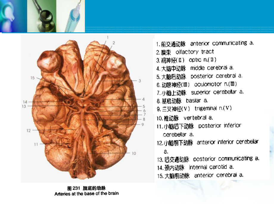 脑血管病脑出血和脑缺血教学幻灯片_第4页