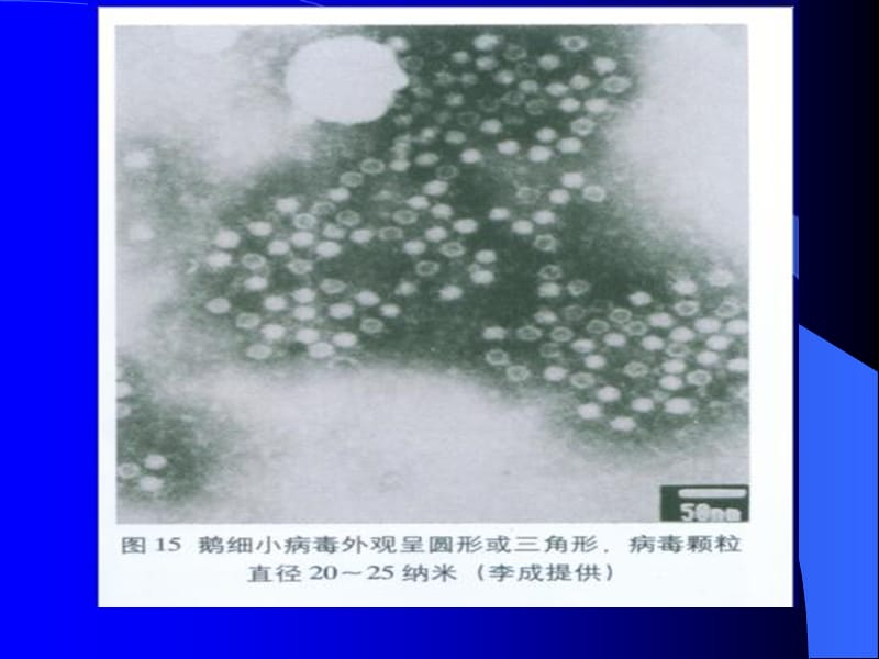 聊城大学农学院《禽病学》课件之病毒病小鹅瘟ppt课件_第4页