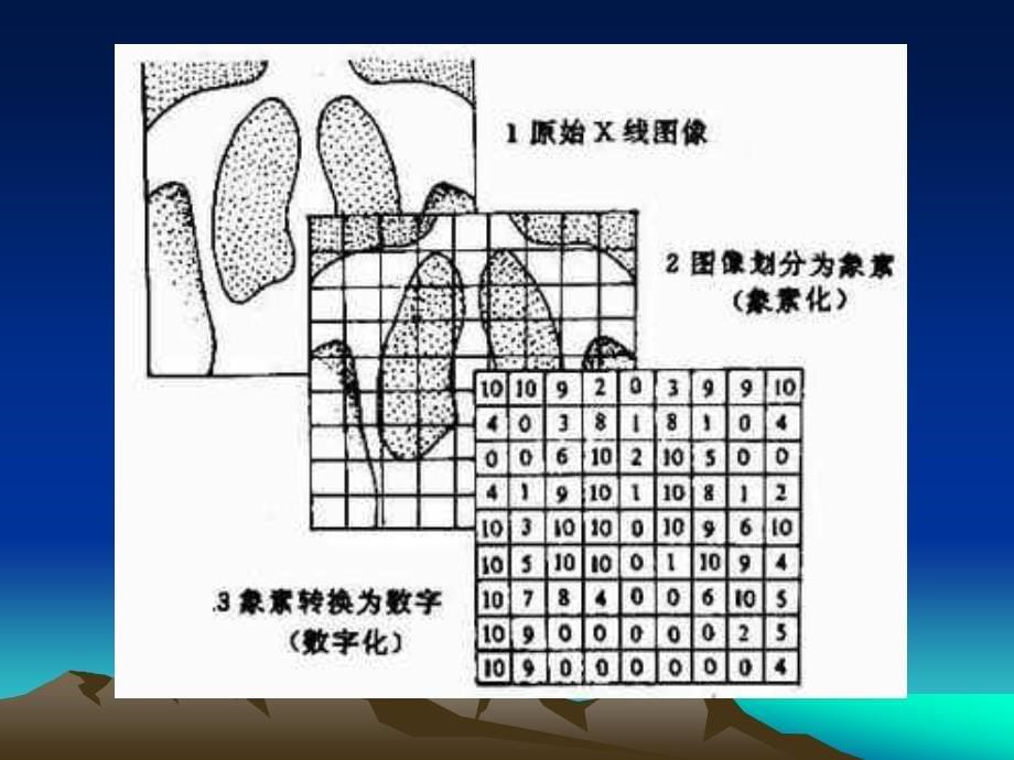 数字减影血管造影DSAppt课件_第5页