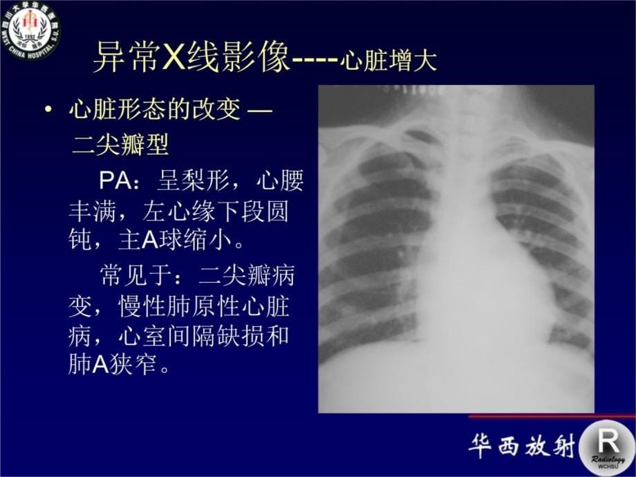 循环系统影像学2-2教学幻灯片_第5页