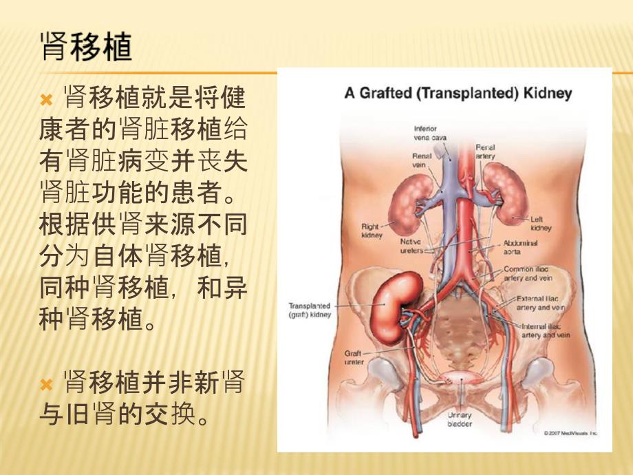 肾移植简介教材课程_第1页