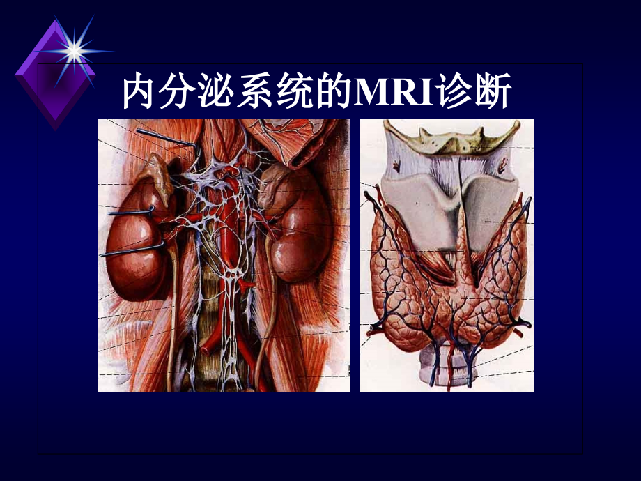 内分泌系统疾病的MRI诊断讲义教材_第1页